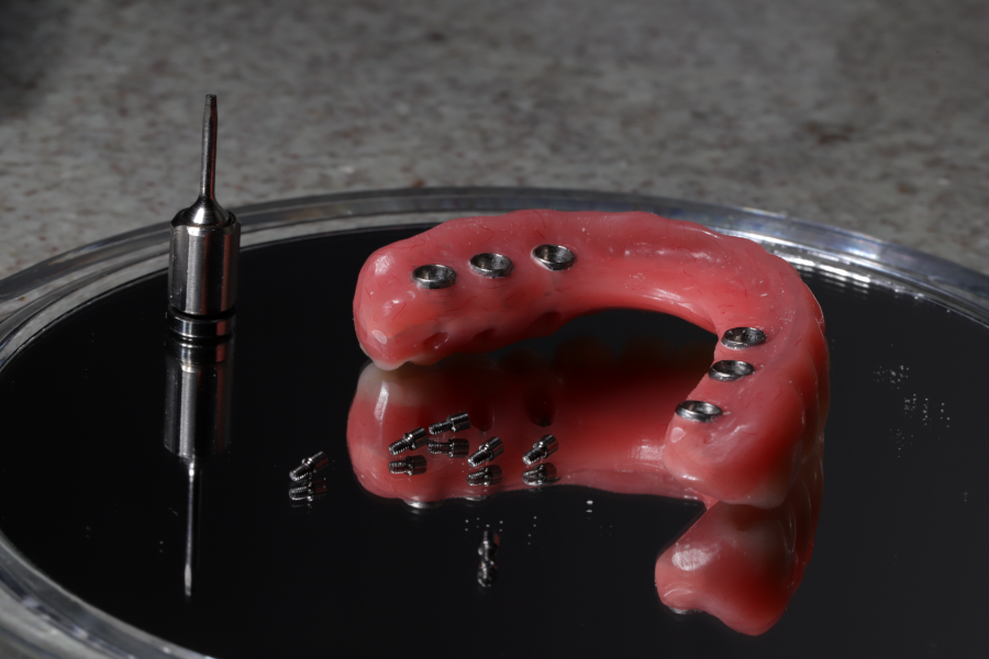 Prótese sobre implantes
